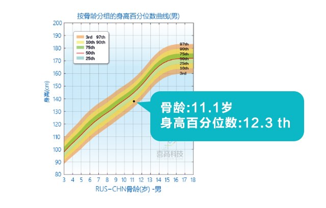 判斷孩子的高矮？這3點(diǎn)沒(méi)搞清楚會(huì)后悔！_05.jpg