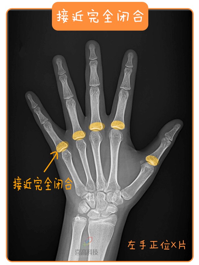 重啟骨骺線~你看起來很誘人！_13.png