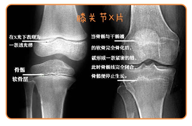 重啟骨骺線~你看起來很誘人！_14.png